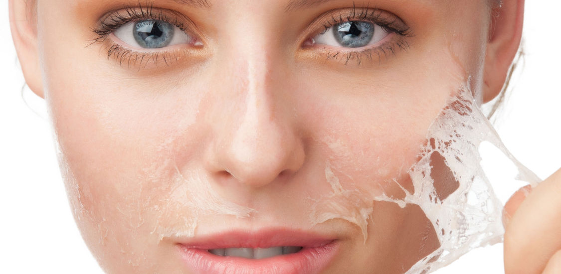 Microdermoabrasión – Higiene Facial